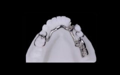 What Materials Are Used in Dental Metal Frameworks?