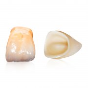 How to ensure that the service life of all-ceramic teeth can be longer?