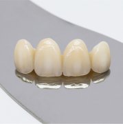 All-ceramic teeth, helping you get rid of gum black lines forever!
