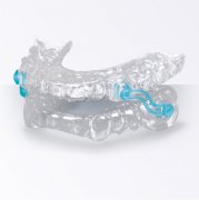 Silence the ＂Nightly Symphony,＂ Reclaim Restful Sleep — china dental Anti-Snoring Device: Resto