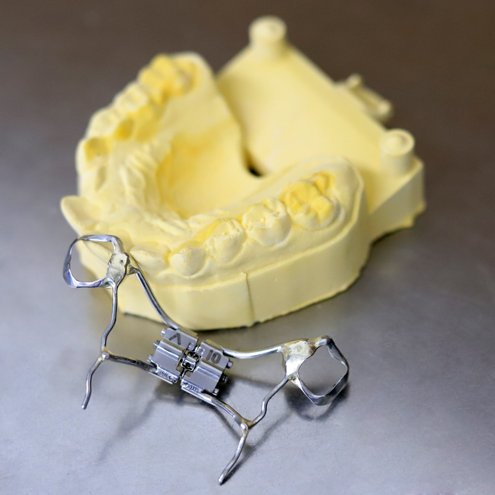 Hyrax Rapid Palatal Expander: Efficiently Resolving Narrow Dental Arches, Rebuilding the Foundation f