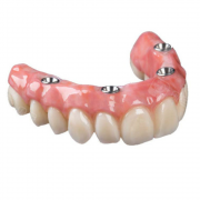 All-On-X Dental Implants: Rapid Tooth Restoration for Natural Chewing