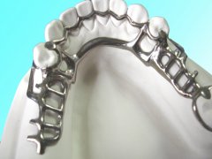 Hyper-Titanium Framework Creates ＂Breathable Dentures＂