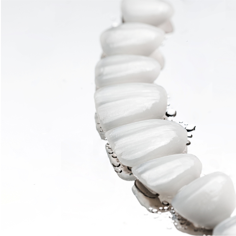 Say Goodbye to Fluorosis and Tetracycline Stains: Ultra-Thin Porcelain Veneers Restore Your Naturally