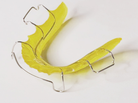 Lasting Stability, Effortless Breathing – The Long-Term Retention Power of the Hawley Retainer(Orth