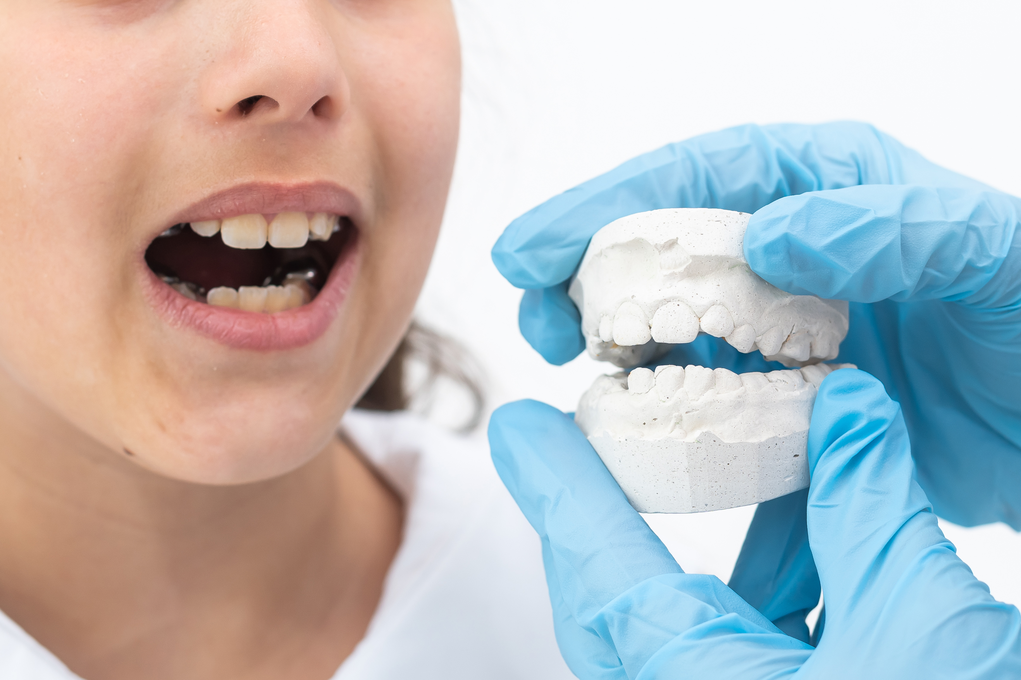 Protecting Nocturnal Oral Health: Custom Night Guards Safeguard Your Teeth