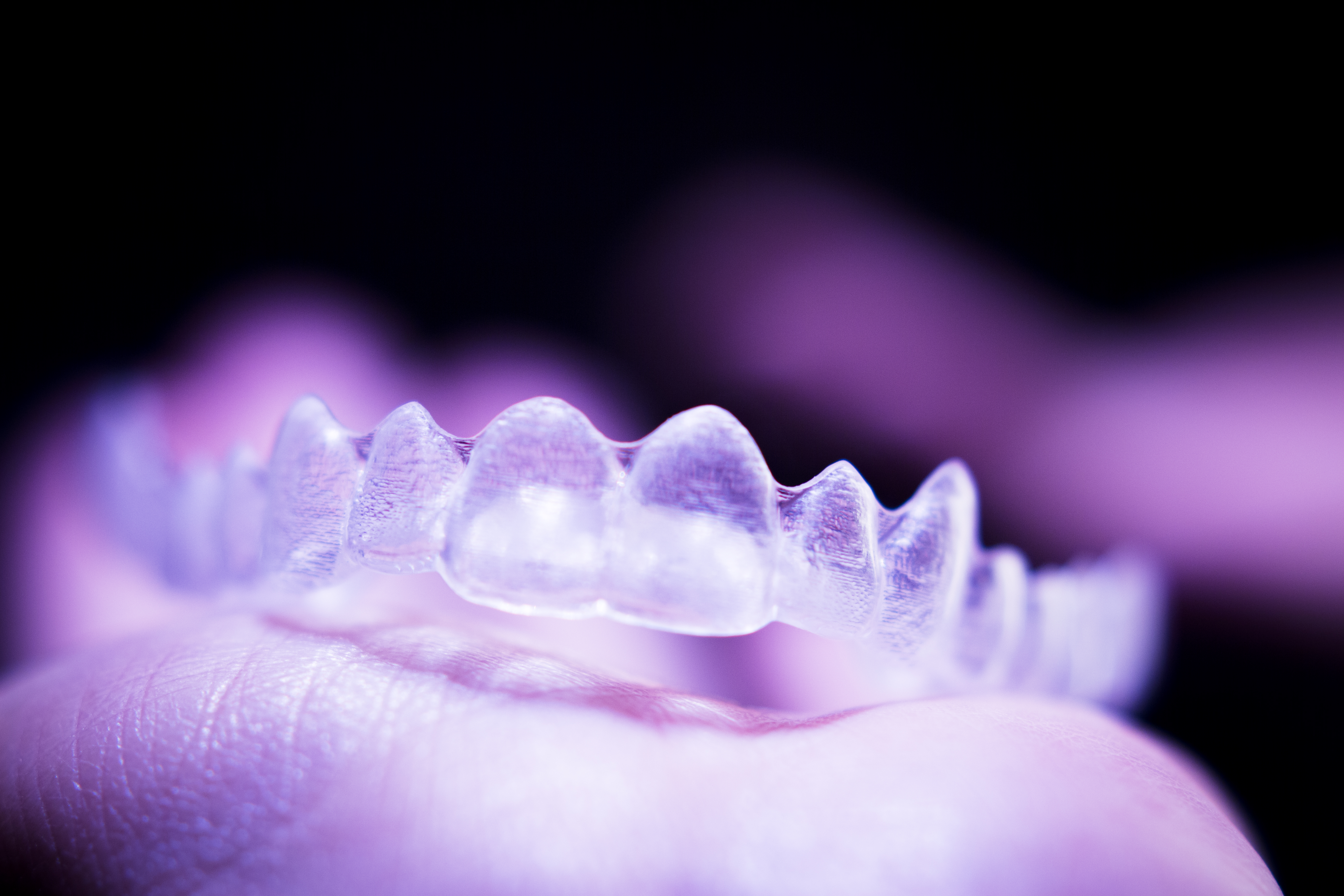 Why Do You Need to Wear a Retainer After Orthodontic Treatment?