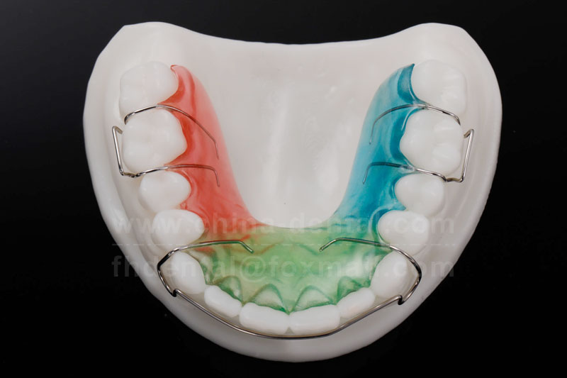 Hawley Retainers: Precision Adjustment – The Professional Choice for Complex Dental Spacing