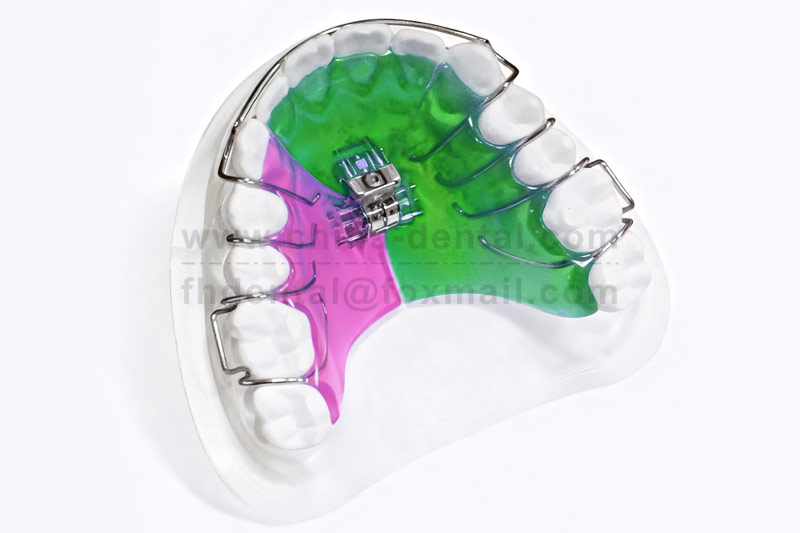 Three-Directional Expander: Scientific Correction for Improved Dental and Jaw Alignment