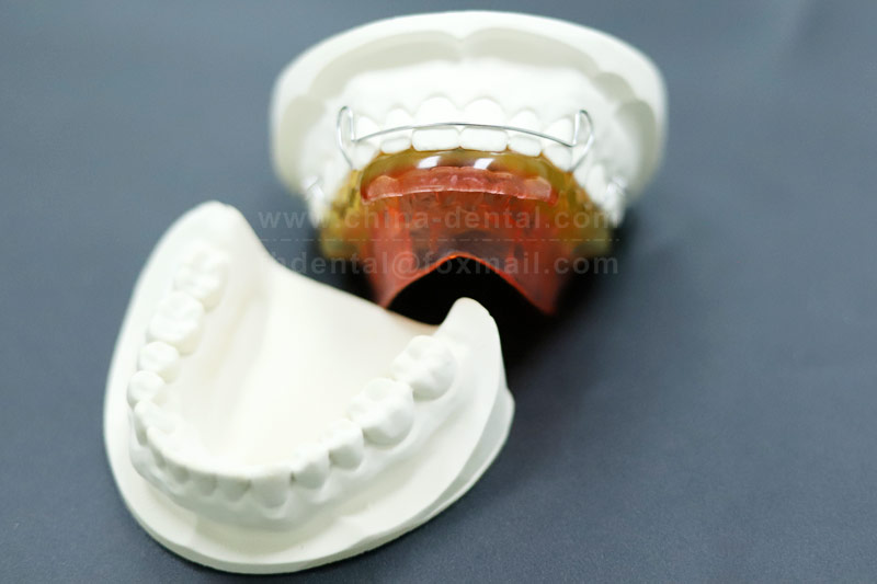 Myofunctional Activator: A Scientific Choice for Early Correction of Malocclusion