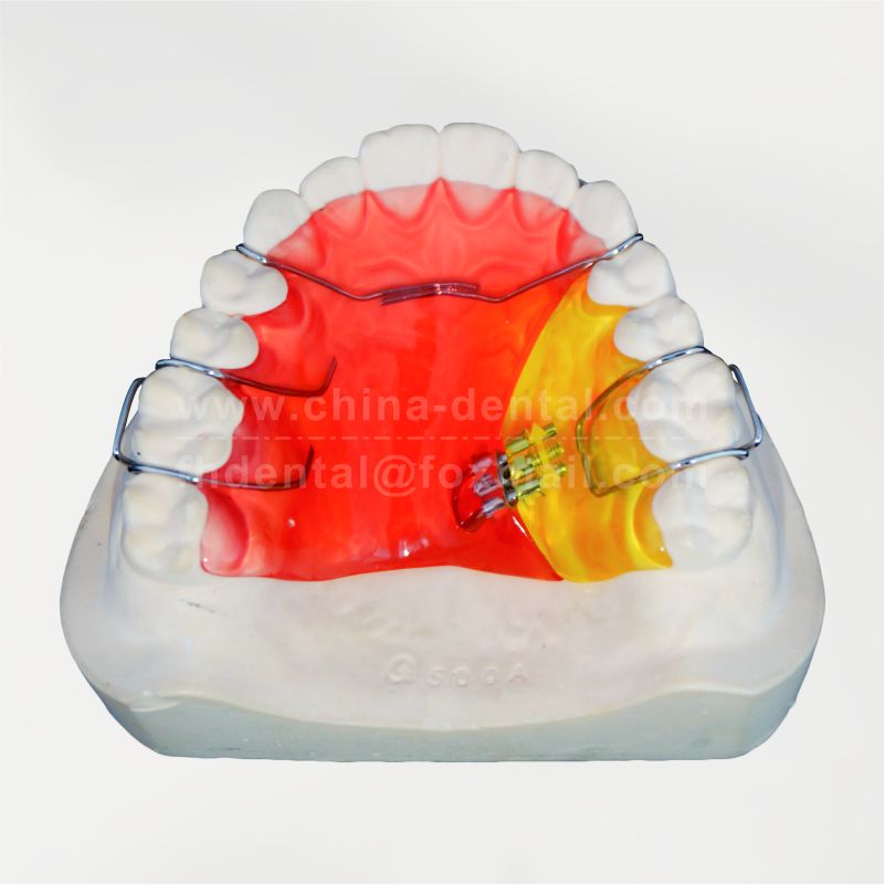 Unilaterial Spiral Expander