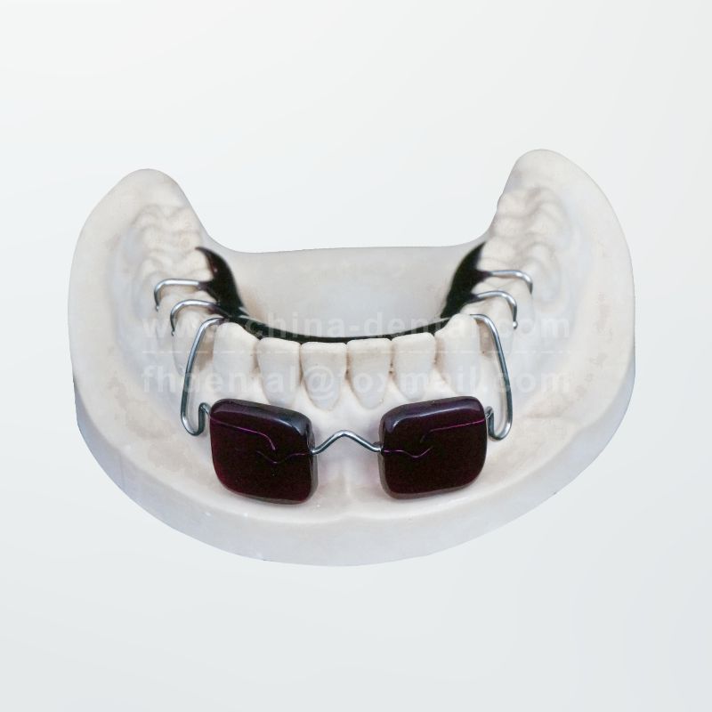 Removable Mandibular Lip Bumper (Base Plate Type)	