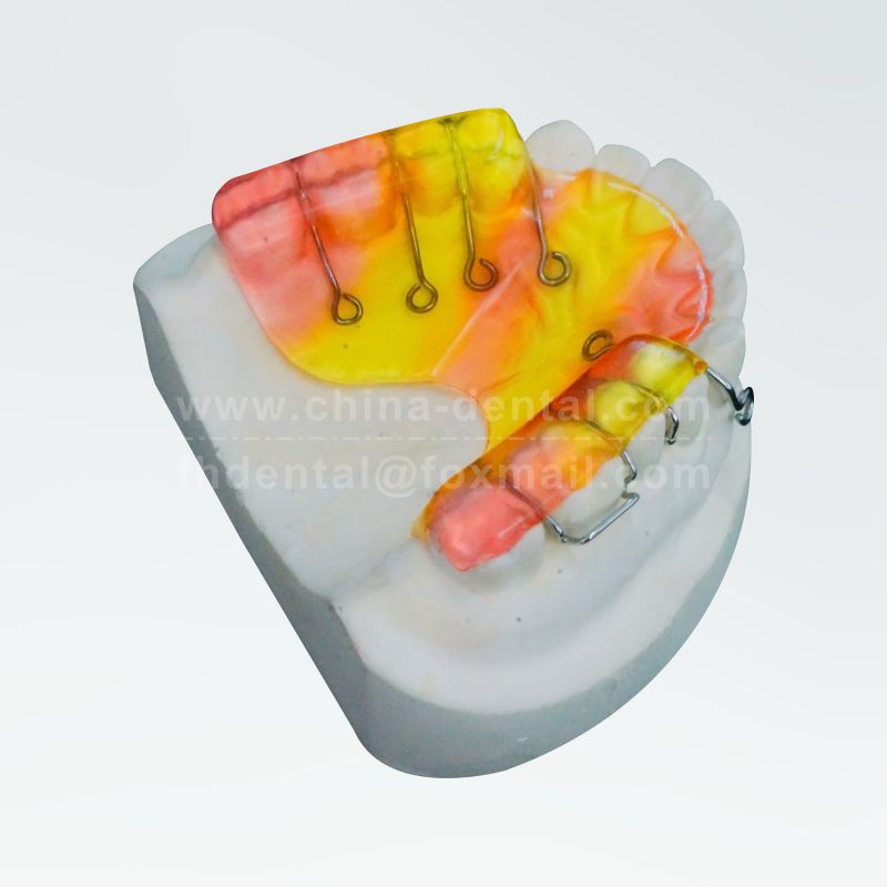 Removable Anterior Traction Appliance (Base Plate Type)