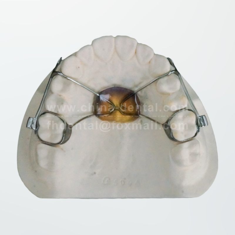 Anterior Traction Appliance(Band-anchored)	