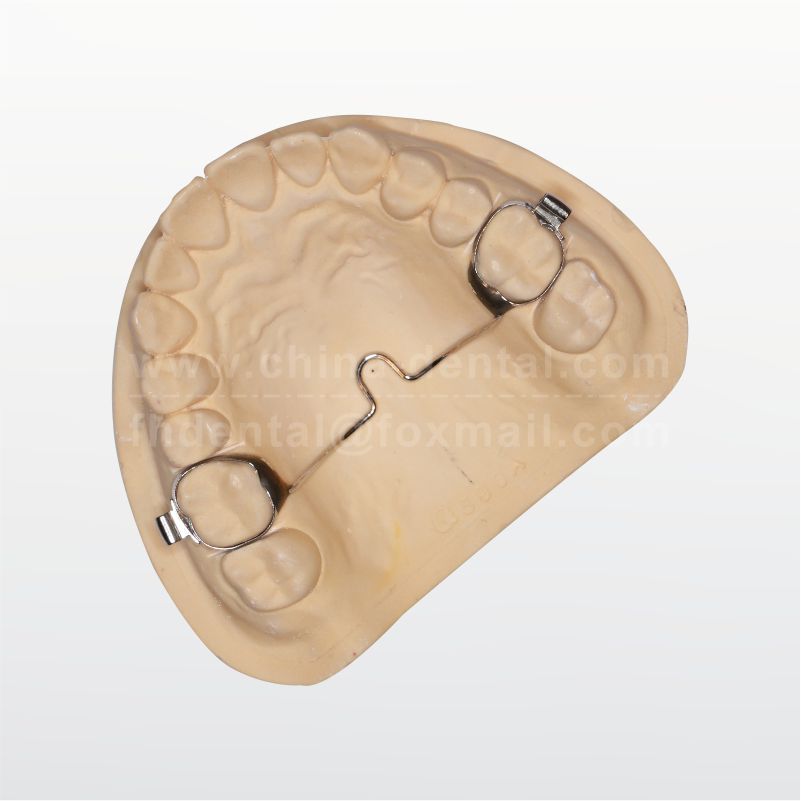 TPATransverse Palatal Arch