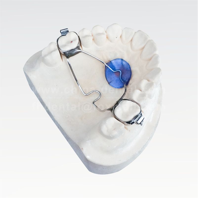 Anchorage Enhencement Appliance