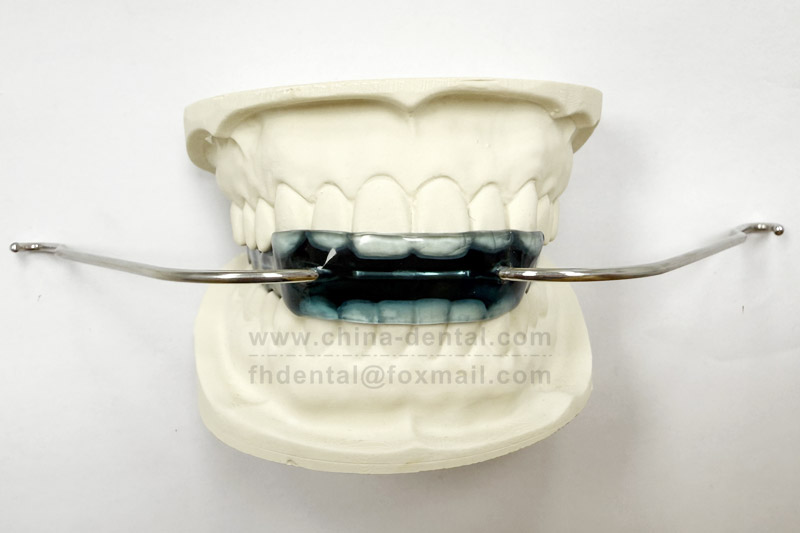 Scientifically Guiding Tooth Eruption: Van Beek Headgear-Activator Aids in Correcting Deep Overbite in Children