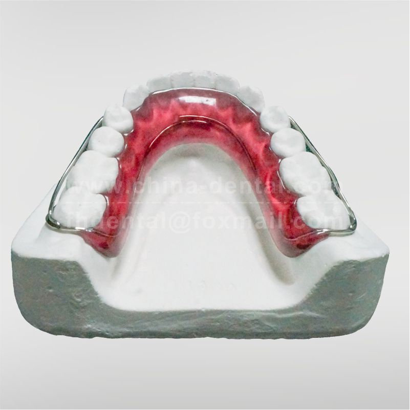 Bonded Retainer