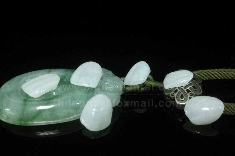 A New Choice for Dental Aesthetics: Ultra-Thin Porcelain Veneers, Minimally Invasive Beauty in One Application