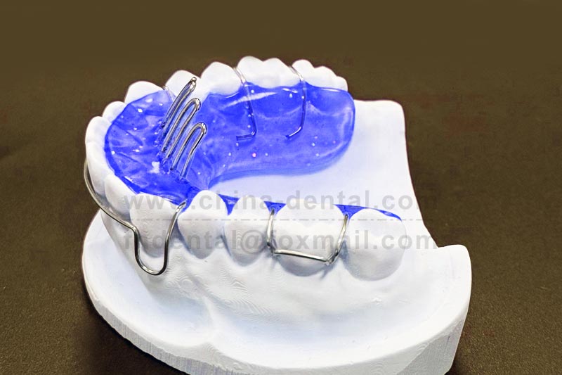 Eliminate Bad Oral Habits, Protect Children's Dental Health – Introduction to the Tongue Grid Appliance Eliminate Bad Oral Habits, Protect Children's Dental Health – Introduction to the Tongue Grid Appliance