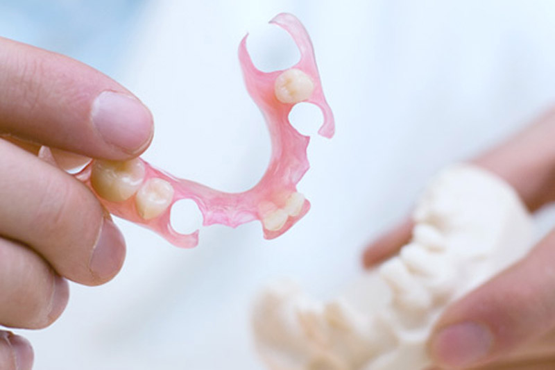 Say Goodbye to Metal Clasps, Reveal a Natural Smile – Flexible Partial Dentures for More Aesthetic Restoration
