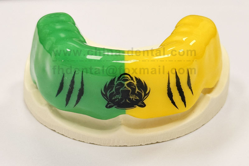 Customized for You, Comfort on the Move: Your Personalized Sports Mouthguard