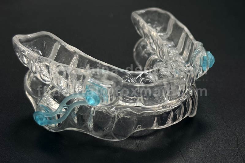 Precision Manufacturing, Quality Assurance: A Dental Laboratory Guide to Producing Anti-Snoring Devices