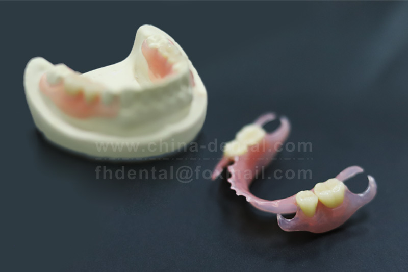 Flexible Partial Dentures: Making Dental Restoration Feel Like Natural Regeneration