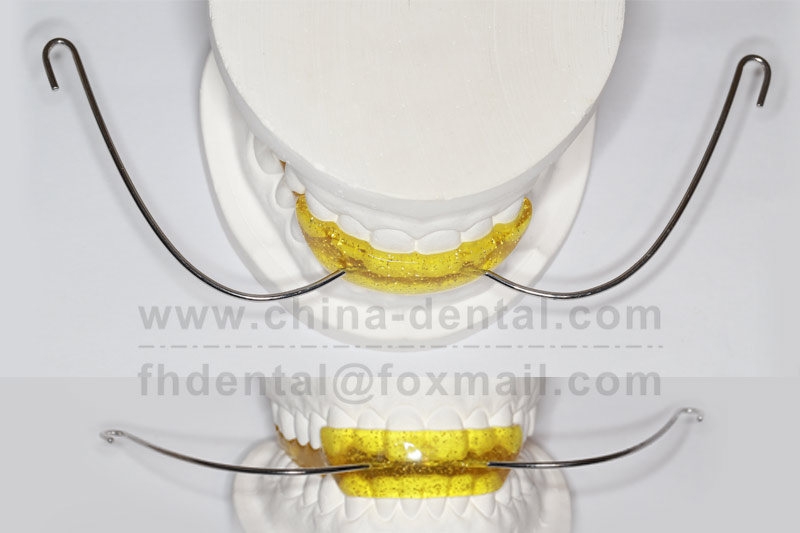 Targeted Solution for Class II Malocclusion: Understanding the Treatment Process and Advantages of the Van Beek Headgear-Activator