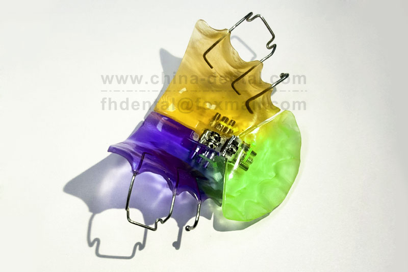 Removable Three-dimensional Expander: Efficient Solution for Insufficient Dental Arch Development