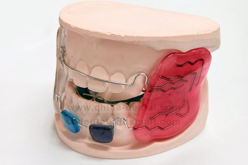 Early Intervention for Pediatric Mandibular Retrognathia – The Role of Frankel II Functional Appliance