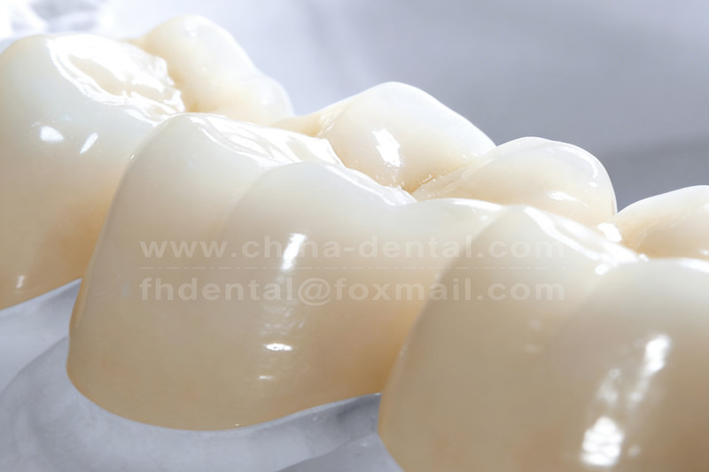 Restore Your Natural Smile: A New Experience in Aesthetic Dentistry with All-Ceramic Crowns Restore Your Natural Smile: A New Experience in Aesthetic Dentistry with All-Ceramic Crowns