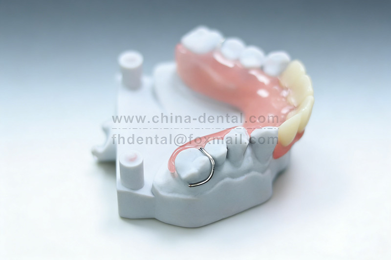 Managing Complex Tooth Loss: Metal-Based Partial Dentures Balancing Comfort and Protection Managing Complex Tooth Loss: Metal-Based Partial Dentures Balancing Comfort and Protection
