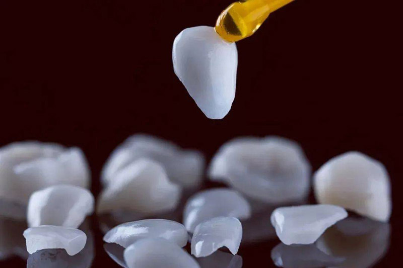 Porcelain Veneers: More Than Just Cosmetic Enhancement, a Gentle Protection for Your Teeth