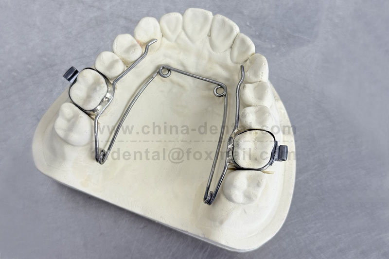 Narrow dental arch causing teeth to crowd together? The Four-Eye Spring Expander is a gentle and effe