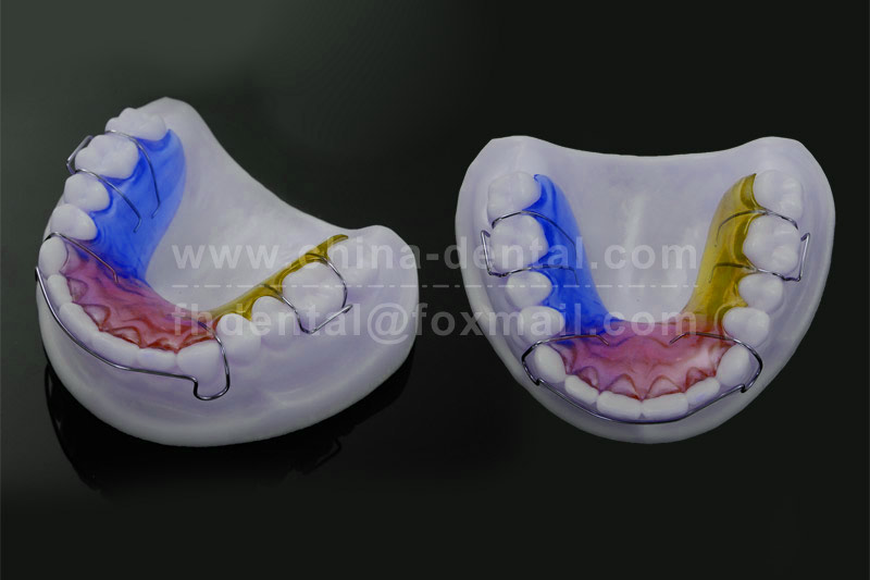 After orthodontic treatment, choose the Hawley retainer – it keeps your teeth firmly in place.