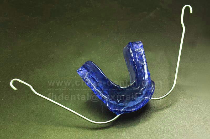 Correct “buck teeth” while sleeping? The Van Beek appliance makes mixed-dentition treatment easier.