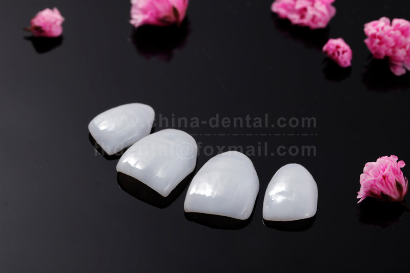  Ultra-Thin Porcelain Veneers – Effortlessly Achieve a Confident Smile