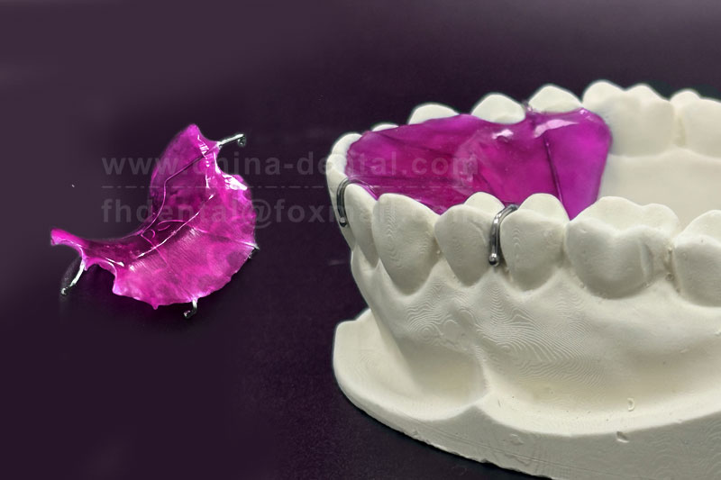 A deep overbite does not necessarily have to wait until all permanent teeth have fully erupted; the M