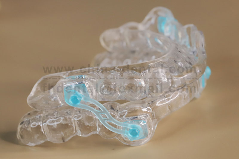 Precision Fabrication: Every Anti-snoring Device Stands Up to Clinical Scrutiny Precision Fabrication: Every Anti-snoring Device Stands Up to Clinical Scrutiny