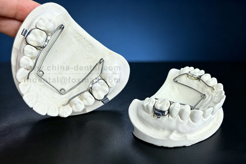 Four-Eye Spring Expander – Gently Creating Space with Mild Force for Narrow Dental Arches and Crowded Teeth Four-Eye Spring Expander – Gently Creating Space with Mild Force for Narrow Dental Arches and Crowded Teeth