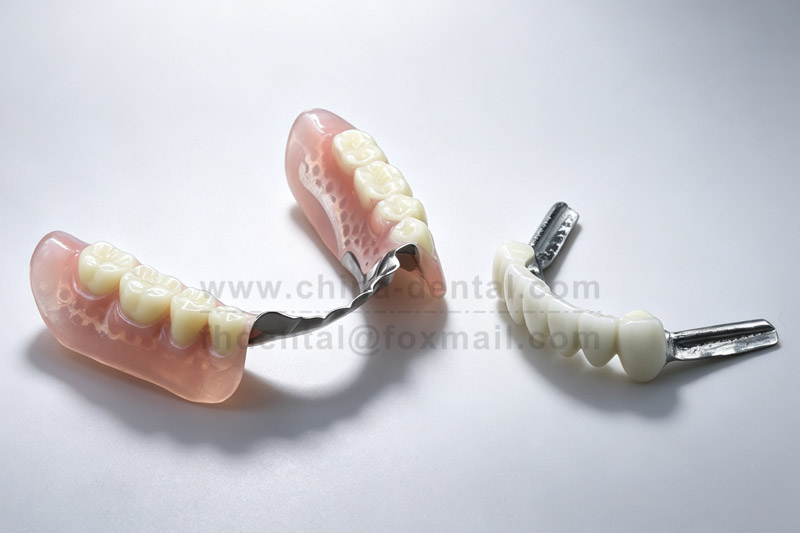 No trapped debris, no harm to gums—precision attachments deliver both cleanliness and durability.