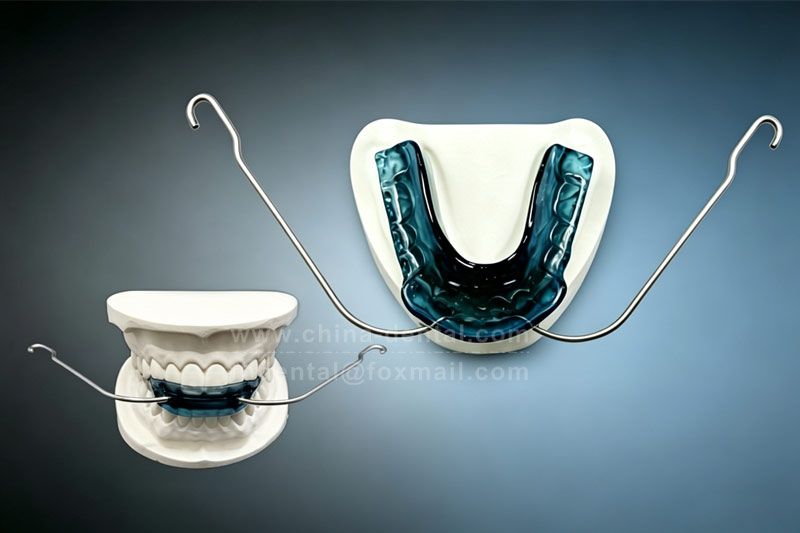 Don’t let your child keep “grinning with exposed gums” – the Van Beek activator gently lets posterior teeth erupt and brings anterior teeth back.
