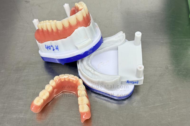 Many missing teeth? The stable performance of acrylic dentures offers greater peace of mind.