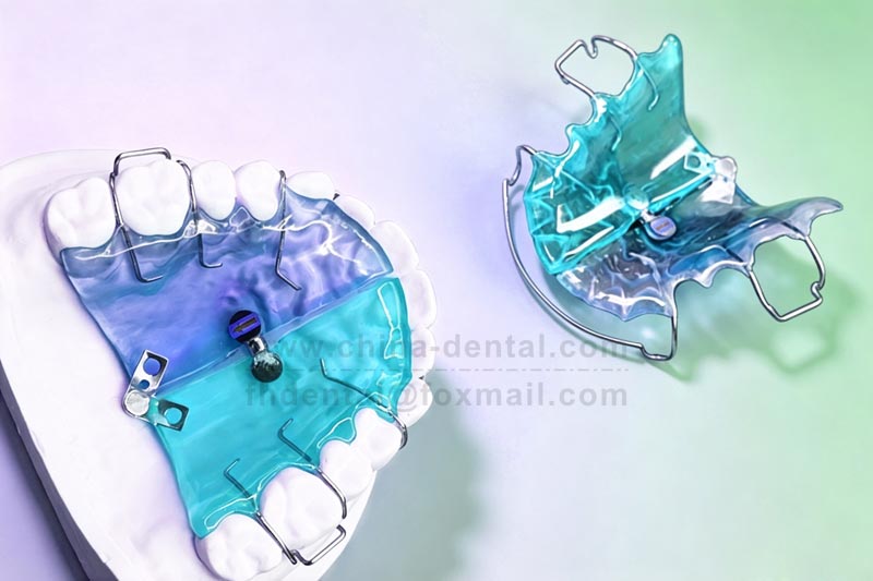 Don't panic about crowding in the mixed dentition – the Fan-shaped Expander gently guides teeth into alignment.