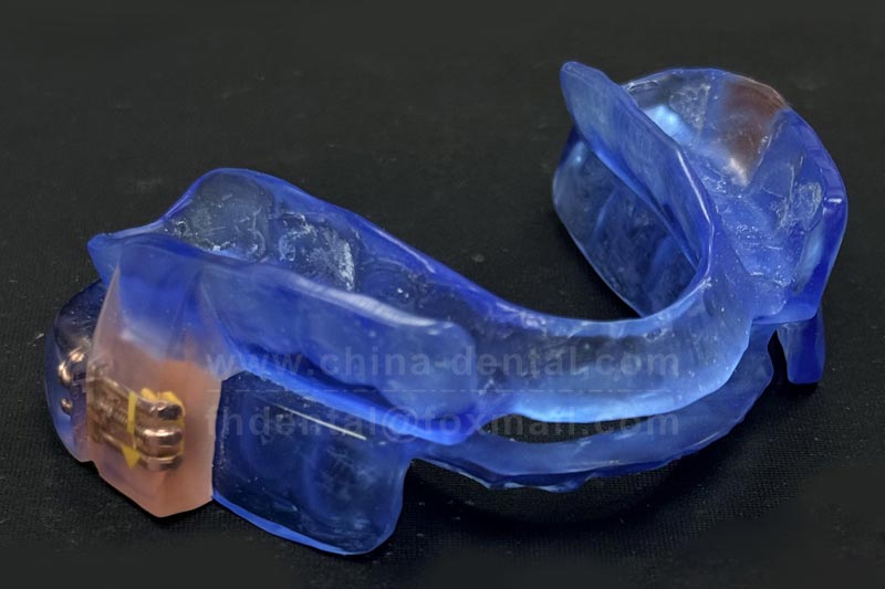 No needles, no surgery: how an anti-snoring device can transform your sleep