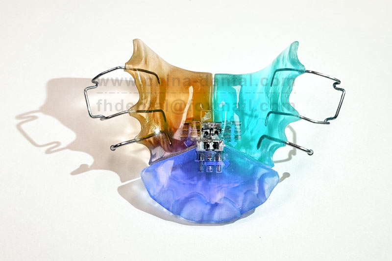 Wearing a Three-dimensional Expander: Easily Creating Space for Crowded Teeth