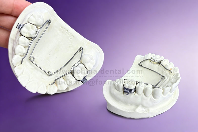 In the Early Stage of Orthodontics, Use a Four-Eye Spring Expander First to Easily Solve the Problem of a Narrow Dental Arch In the Early Stage of Orthodontics, Use a Four-Eye Spring Expander First to Easily Solve the Problem of a Narrow Dental Arch
