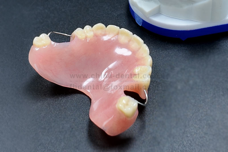 Acrylic Denture Makes Eating and Smiling Easier Acrylic Denture Makes Eating and Smiling Easier
